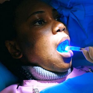 Blanqueamiento Dental LED