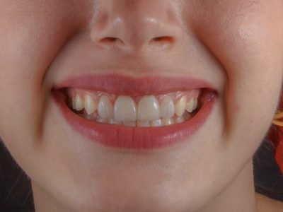 Clínica Dental en Tossa de Mar